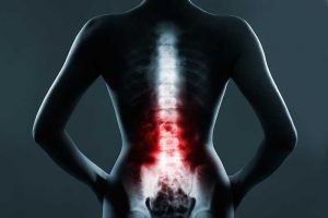 Desynchronization of Our Internal Clock Could be a Risk Factor for Low Back Pain