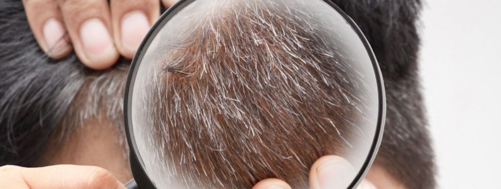 Tissue Aging and Gray Hair Determined by Biological Clock