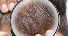 Tissue Aging and Gray Hair Determined by Biological Clock