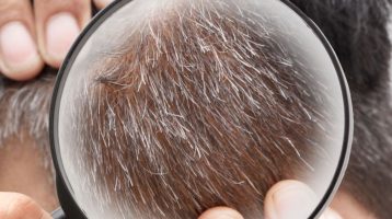 Alterung des Gewebes und graue Haare werden von biologischer Uhr bestimmt