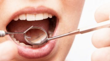 Melatonin und Parodontitis: Eine vielversprechende Behandlung