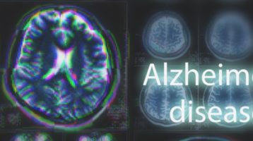 Are Sleep Apnea and Alzheimer's Disease Linked?