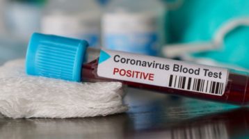 Melatonin Protects Mitochondria From Deleterious Impact of Coronaviruses
