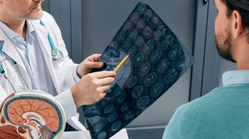 Betennelse i ung voksen alder har innvirkning på mental helse